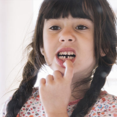 Children Oral health What all parents need to know2