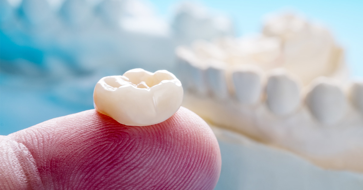 Is Zirconia Crown better than other Crown options-3