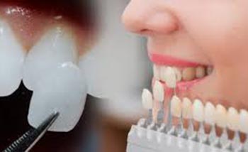Best Dental clinic in Delhi